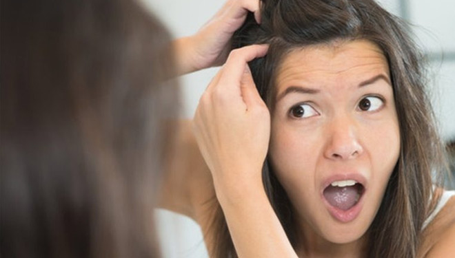 Tips Alami Mengatasi Rambut Beruban