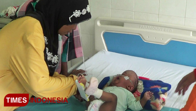 Kisah Fatimah, Bayi Keluarga Miskin Probolinggo Penderita Penyakit Langka