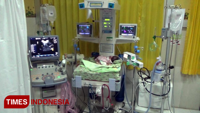 Bayi Lahir Kembar Siam di Probolinggo, Ini Penyebabnya