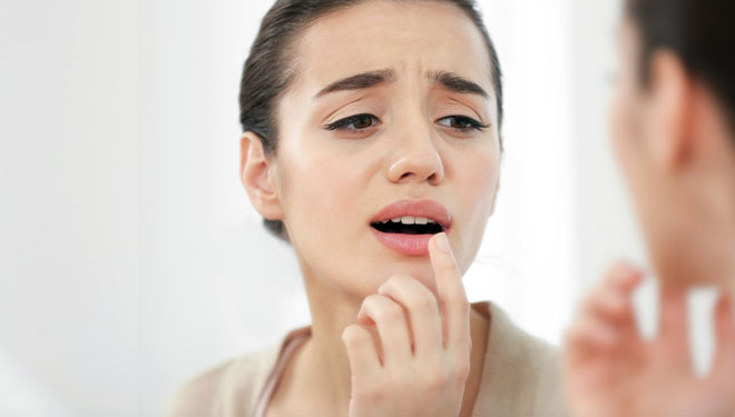 Ilustrasi - Tips mencegah bibir kering (FOTO: pegipegi.com)