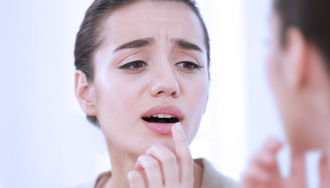 ILUSTRASI - Bibir Kering (FOTO: pegipegi)