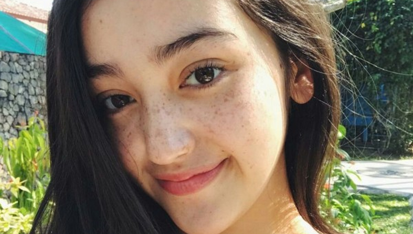 Freckles pada wajah. (instagram.com/rantymaria)