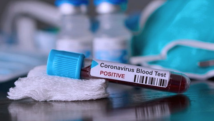 Atasi Dampak Virus Corona, Beberapa Langkah Stimulus Ekonomi Disiapkan OJK
