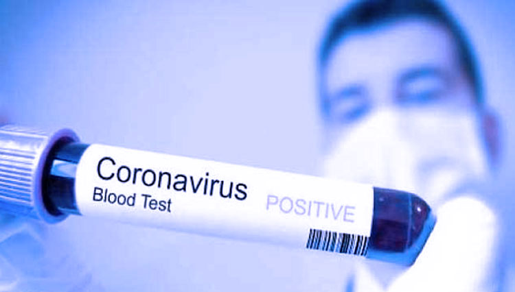 Ilustrasi virus corona, Covid-19.