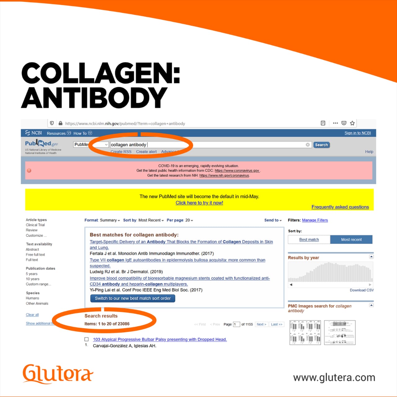 Collagen-Antibody.jpg