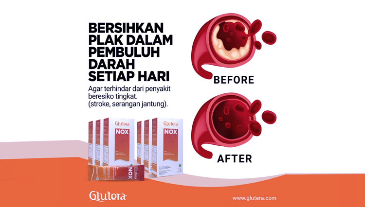 Bersihkan Plak Di Pembuluh Darah Setiap Hari Ini Manfaatnya Times Indonesia 5646