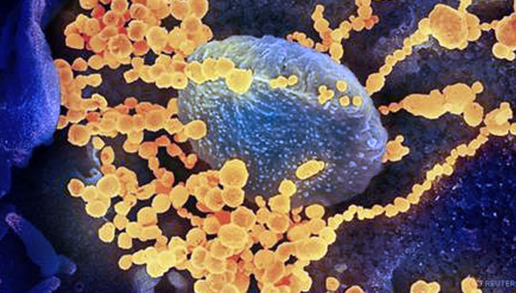 Gambar mikroskop elektron pemindaian menunjukkan SARS-CoV-2 (benda bulat emas), juga dikenal sebagai coronavirus baru. (FOTO: CNA)