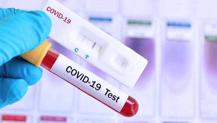 Jumlah Kasus Covid-19 Majalengka Tembus 35 Orang