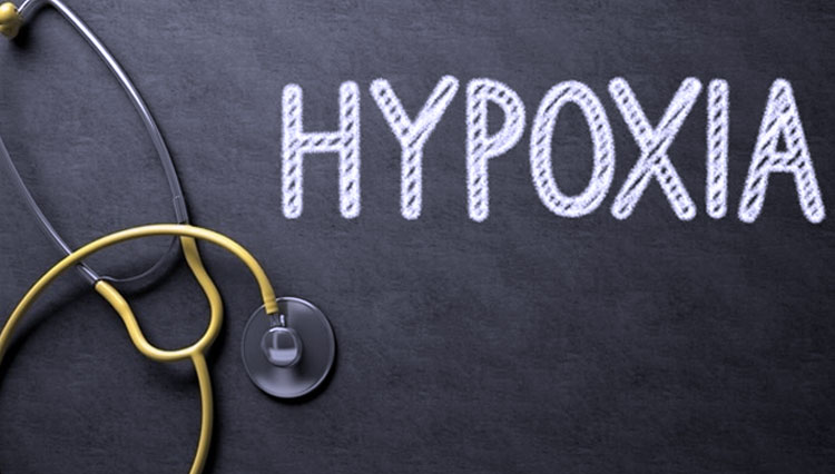 Ilustrasi - Happy Hypoxia Syndrome (FOTO: Tashatuvango/Shutterstock.com)