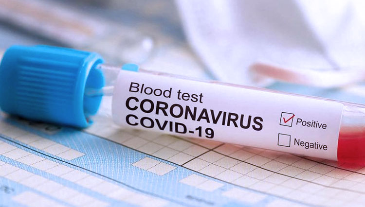 Ilustrasi sampel darah pasien virus corona. (FOTO: Shutterstock)