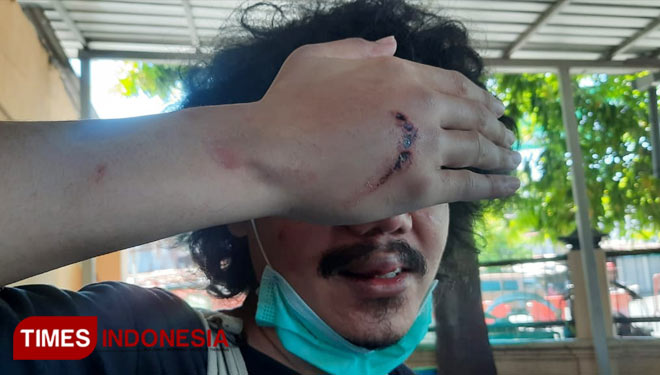 Wartawan online di Surabaya, S yang mengalami pengeroyokan oleh begal di Surabaya. (Foto: Khusnul Hasana/TIMES Indinesia)