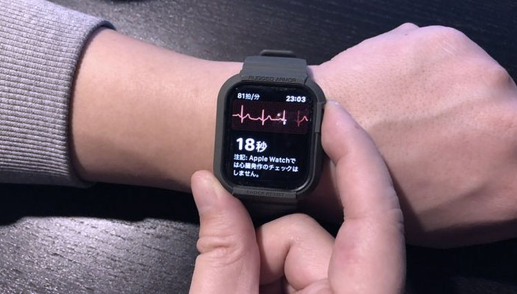 Apple Watch dapat mengetahui detak jantung pemakai maka dari itu dapat diketahui orang tersebut long Covid-19 (Foto: Pinterest)