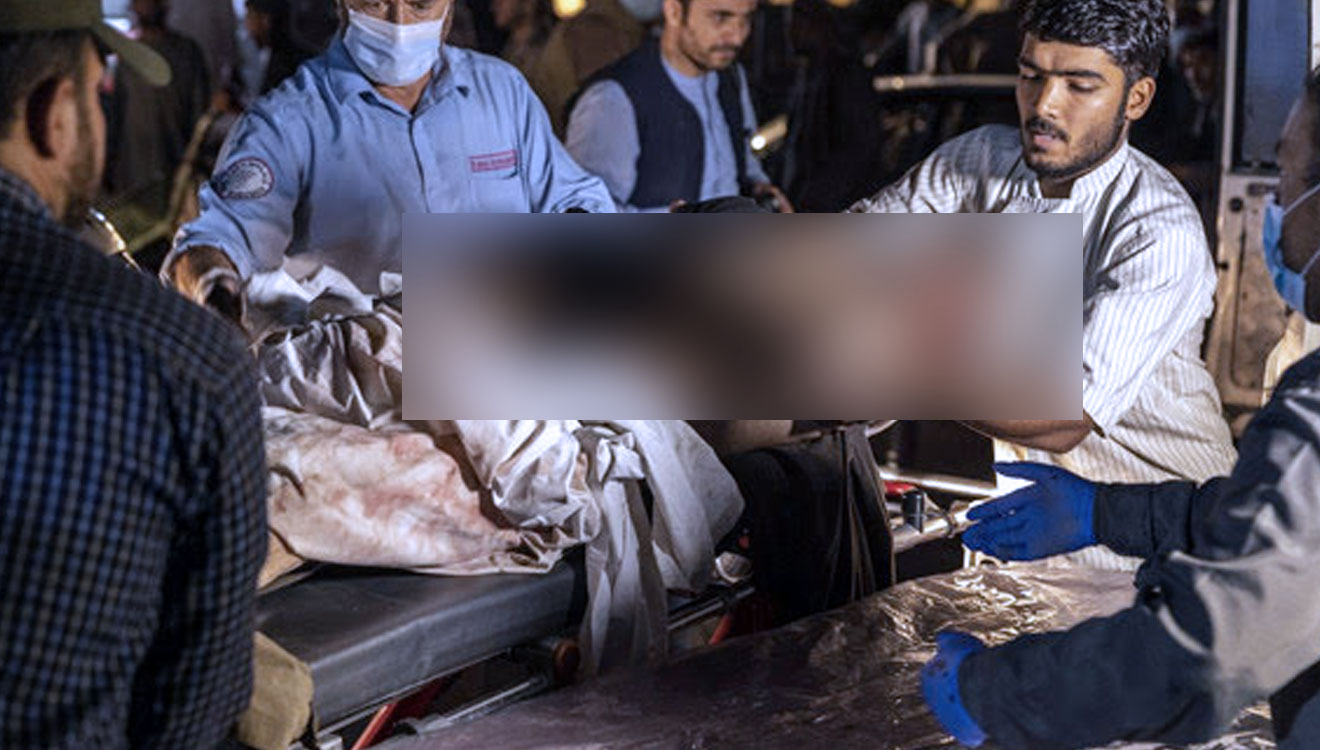 Seseorang yang terluka dalam ledakan bom di luar bandara Kabul, Afghanistan tiba di sebuah rumah sakit di Kabul. (FOTO: Boston Globe/Victor J. Blue/NYT).