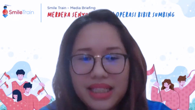 fasilitas operasi bibir sumbing b