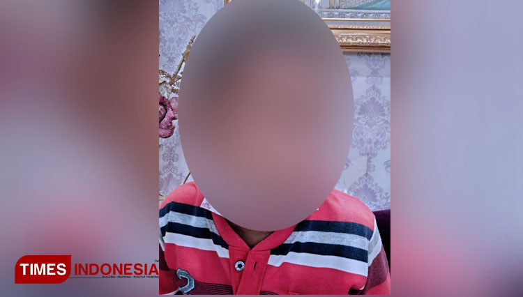 (JANGAN DITIRU) Dianiaya Tetangga, Anak di Cirebon Ini Wajahnya Ditempelkan Knalpot