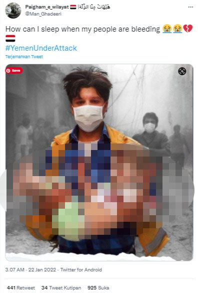 cek-fakta-Foto-Anak-Korban-Serangan-di-Yaman-6.jpg